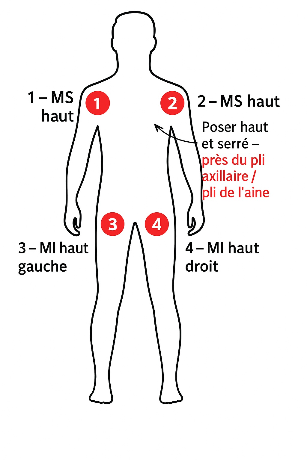 Schéma emplacements tourniquet - bras et cuisses